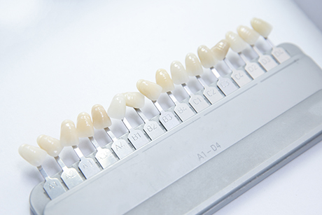 歯の黄ばみを手軽に白くしたい方へ～ホワイトニング～